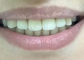 dentalcare