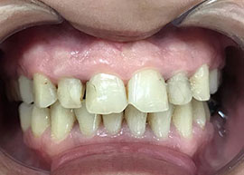 dentalcare