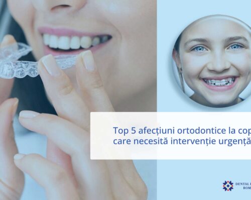 Top 5 afecțiuni ortodontice la copii care necesită intervenție urgență