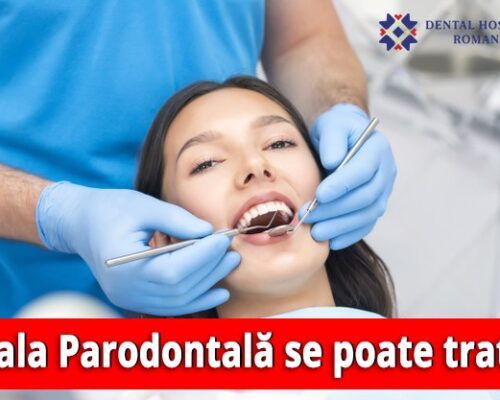 Cum se tratează Parodontoza sau Boala Parodontală?