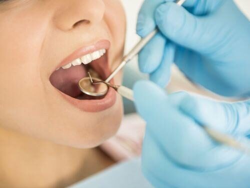 Boala parodontală – forme clinice de manifestare