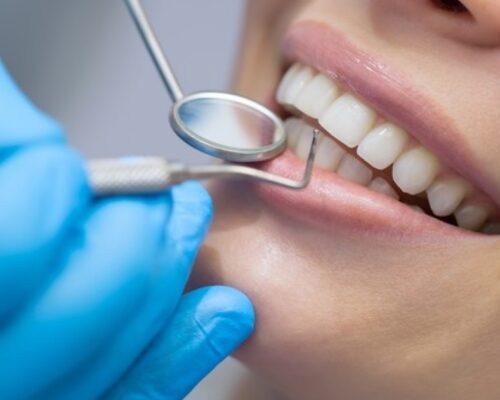 Durerea dentară și alte cauze de algie în sfera orală