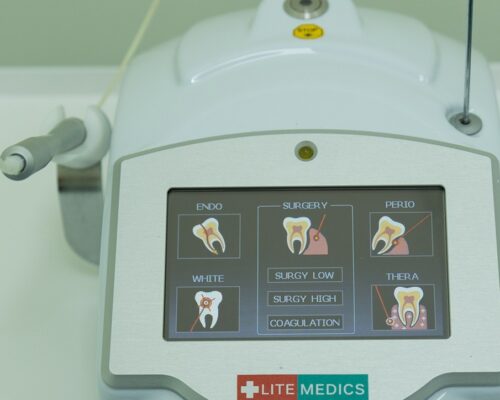 Avantajele laserului dentar