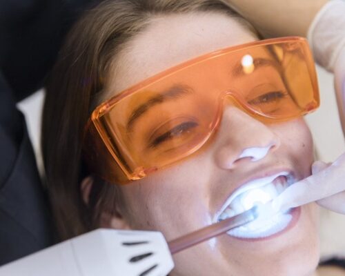 Tratamente cu laser dentar