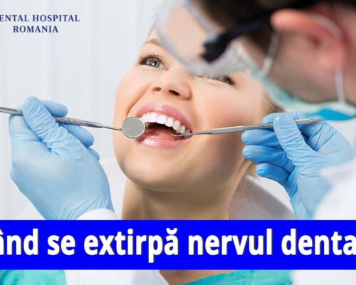 Când se extirpă nervul dentar?