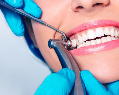 Profilaxia dentară. Cât de important este să previi problemele orale?